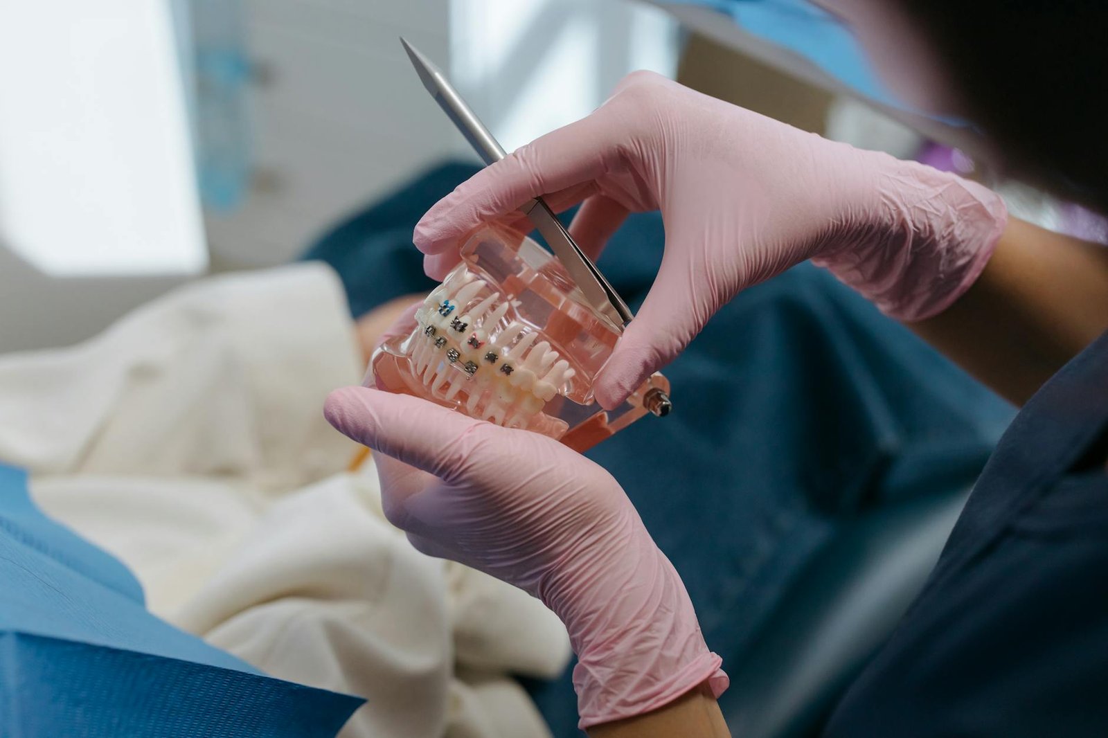 Illustration of Braces Types Tirupati: Exclusive Orthodontic Treatment Options for Best Teeth Alignment