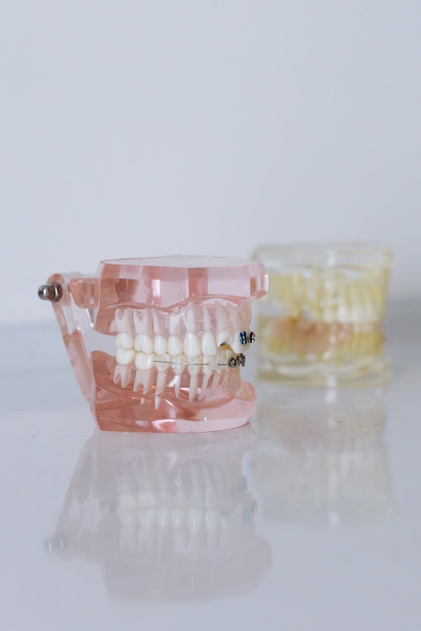 Illustration of Manya Dental Clinic for Braces in Tirupati: Exclusive Affordable Treatment Explained