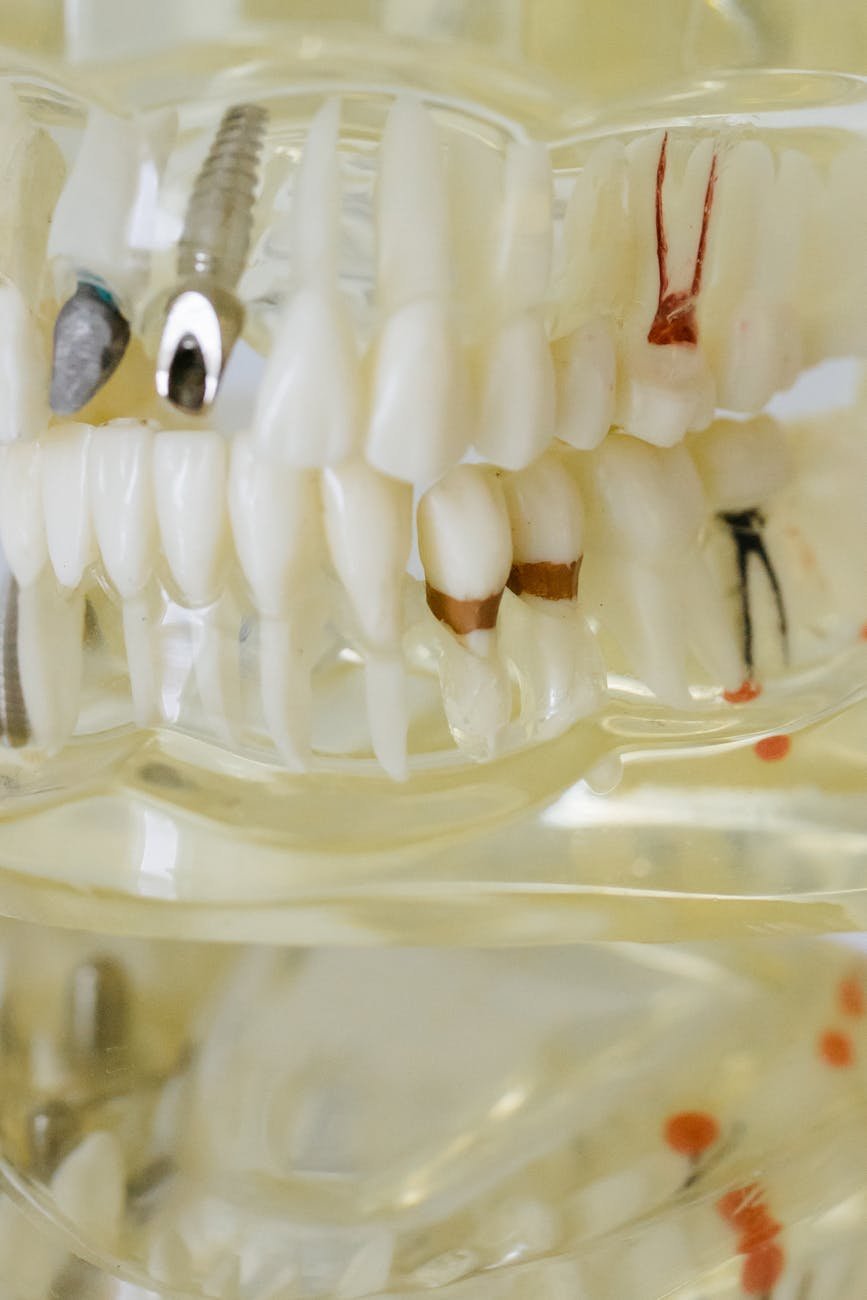 Illustration of Manya Dental Clinic for Root Canal Treatment in Tirupati: Complete Must-Have Guide