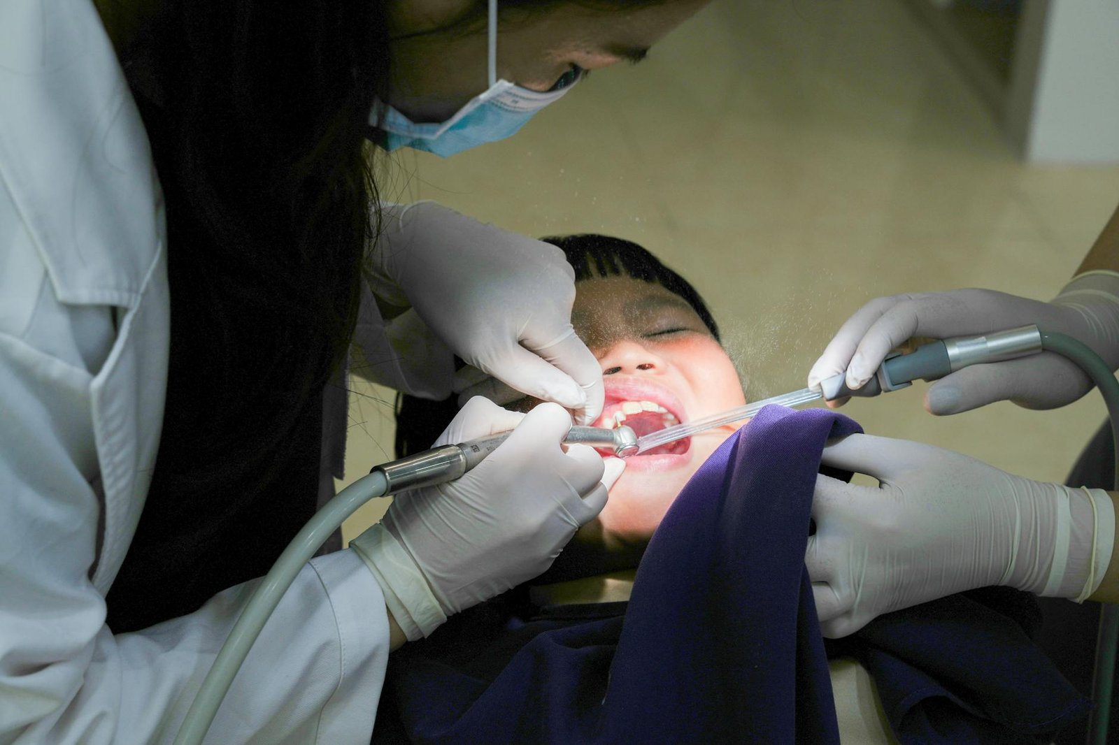 Illustration of Painless Root Canal Tirupati: Must-Know Facts to Ease Your Fear